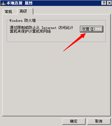本地连接设置